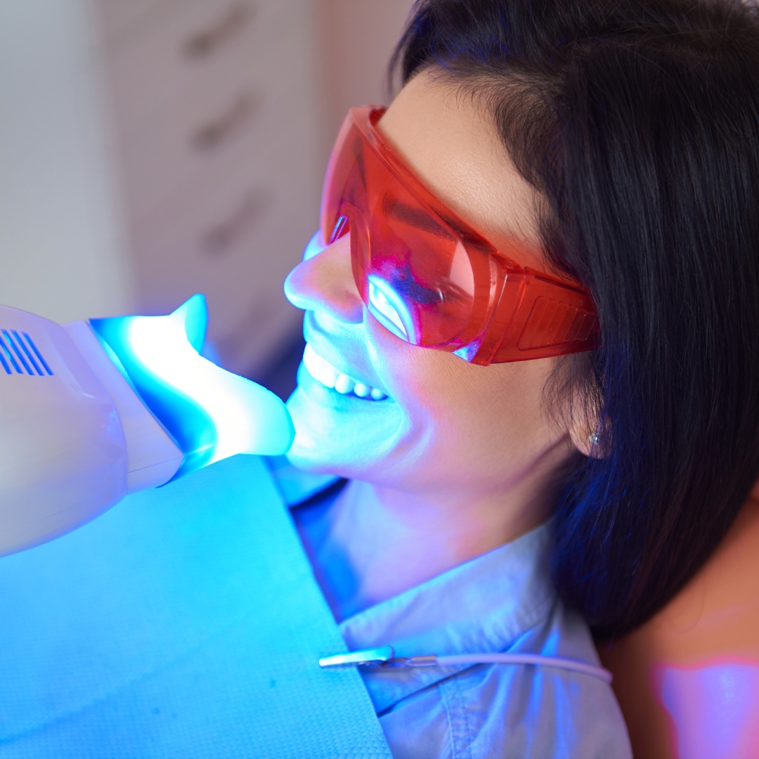 A smiling woman having cosmetic dentistry performed including teeth whitening.